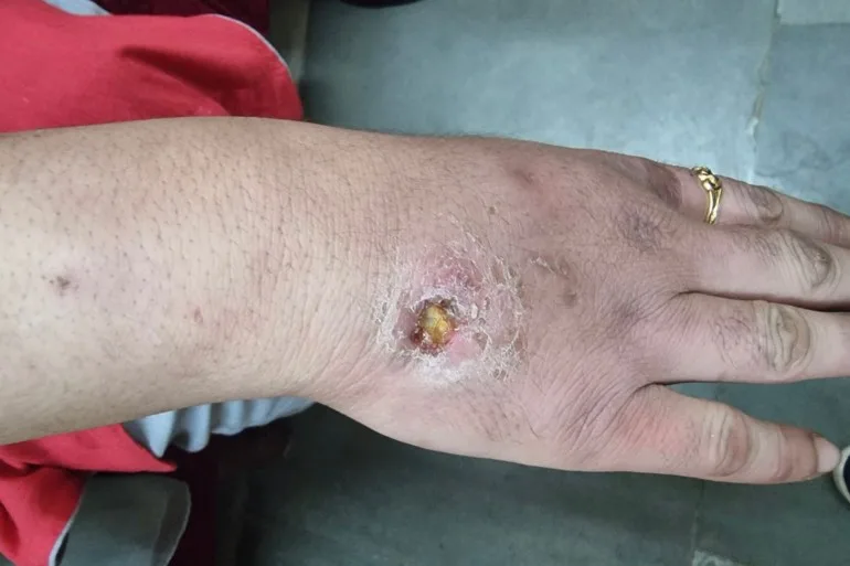 Afiyas Battle: Overcoming Heroin Addiction in Kashmir